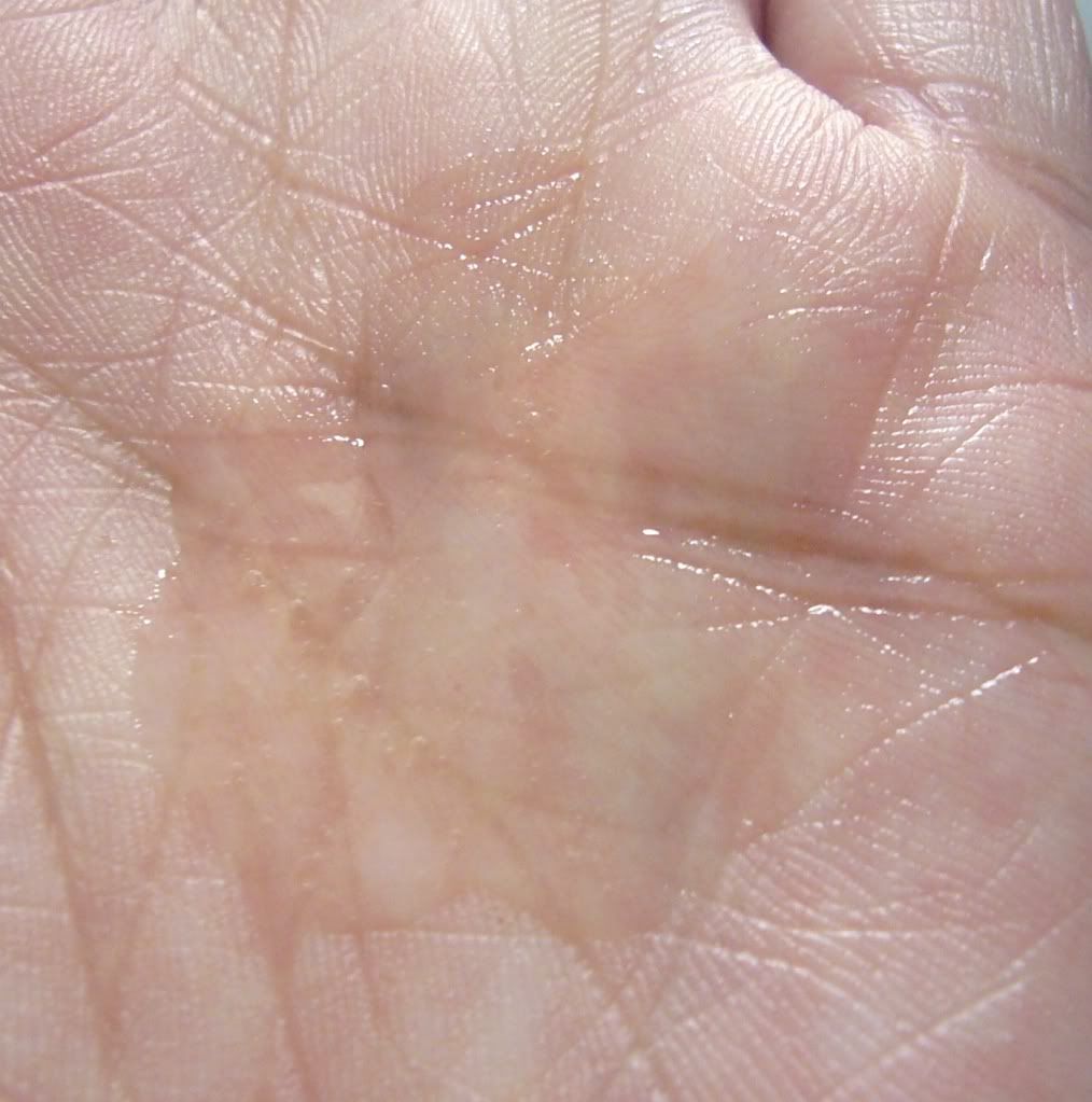 photo JyunkaBotoCavarSerum06.jpg